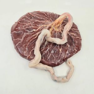 umbilical cord and placenta.jpg